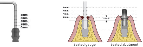 Stealth Abutment Shoulder Depth Gauge